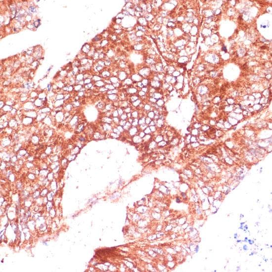 Polyclonal Rabbit anti-Human FAM98A Antibody (IHC)