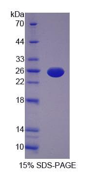Pig IL12A / p35 Protein (Recombinant His-S)