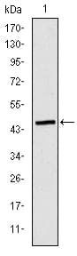 APOB / Apolipoprotein B Antibody (clone 6G6)