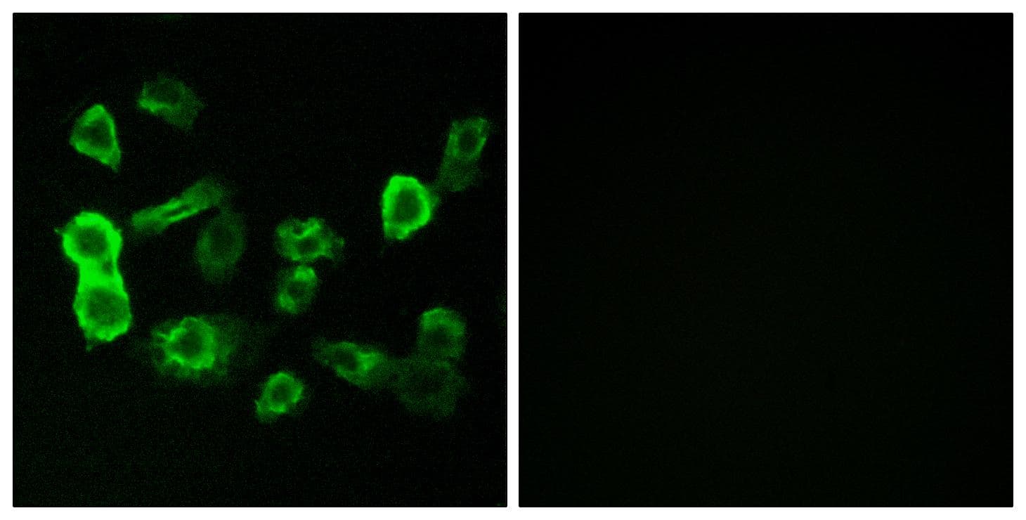 OR5P2 Antibody