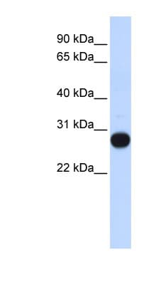 TCEAL4 Antibody (aa107-156)