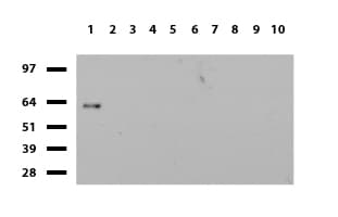 ZSCAN18 / ZNF447 Antibody (clone UMAB113)