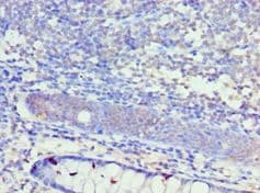 KCNN4 / KCa3.1 Antibody (aa288-427)