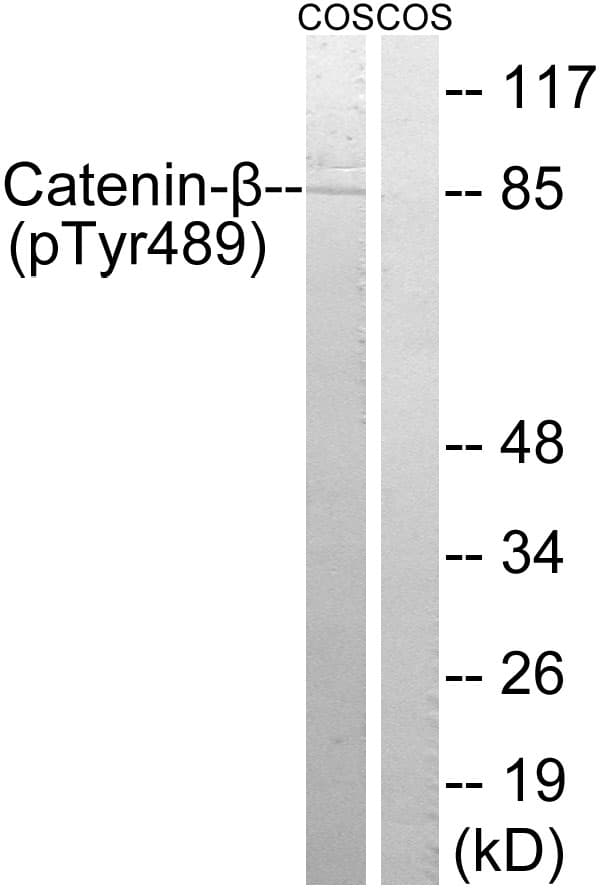 CTNNB1 / Beta Catenin Antibody (phospho-Tyr489)