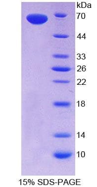 Human SCGF Protein (Recombinant His-GST)