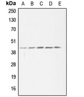 ACAT1 Antibody (Internal)