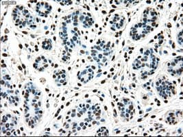 Monoclonal Mouse anti-Human MAP2K4 / MKK4 Antibody (clone OTI2E4, IHC, IF, WB)