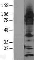 TXN2 / Thioredoxin 2 Protein (Over-Expression Lysate Myc-DDK (Flag))
