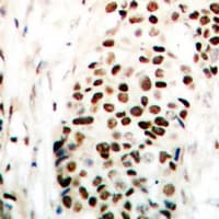 Polyclonal Rabbit anti-Human ZC3HC1 / NIPA Antibody (phospho-Ser354, IHC, IF, WB)