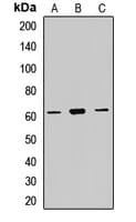 Polyclonal Rabbit anti-Human P4HA2 Antibody (WB)