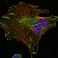 IHC-plus™ lpp Antibody (clone 8B3A11)