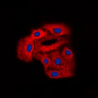 ARSD / Arylsulfatase D Antibody (Internal)