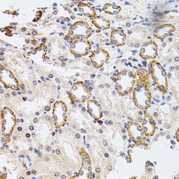 RPS6KA3 / RSK2 Antibody