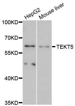 Polyclonal Rabbit anti-Human TEKT5 Antibody (WB)
