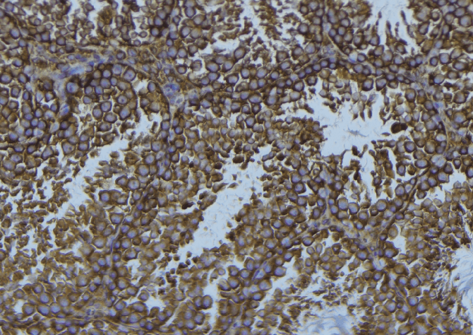 ADA / Adenosine Deaminase Antibody
