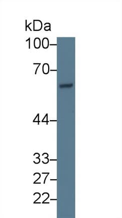 ASNS Antibody (aa213-561, PE)