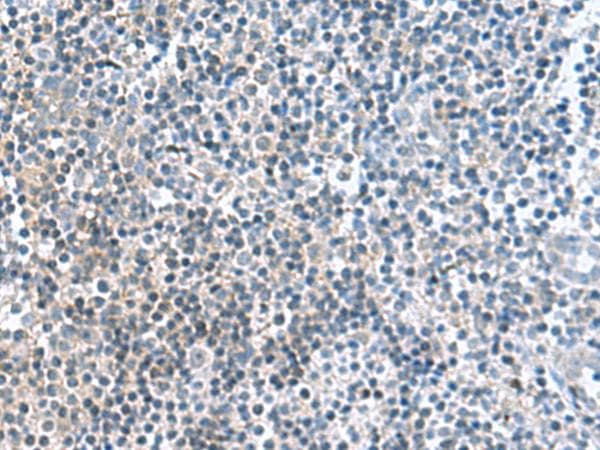 Polyclonal Rabbit anti-Human FAM107B Antibody (IHC)