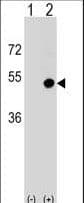 Polyclonal Rabbit anti-Human CD1D Antibody (aa177-206, WB)