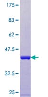 Human ARL9 Protein (Recombinant GST)
