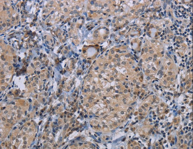 APC6 / CDC16 Antibody