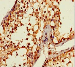 ANKDD1A Antibody