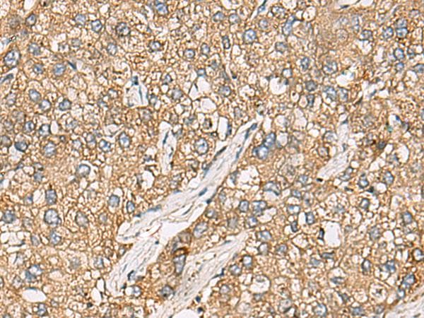 Polyclonal Rabbit anti-Human CHKA / CK / Choline Kinase Antibody (IHC)
