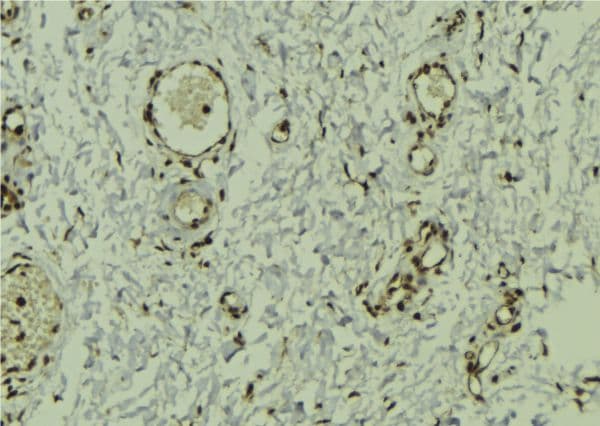 Polyclonal Rabbit anti-Human DEK Antibody (IHC, IF, WB)