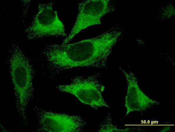 CAST / Calpastatin Antibody (clone 2C5)