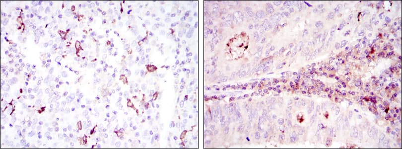 CD1A Antibody (clone 7A7)