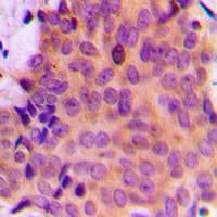 MMP7 / Matrilysin Antibody (C-Terminus)