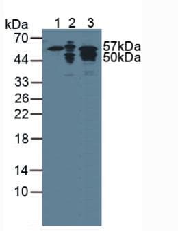 KRT7 / CK7 / Cytokeratin 7 Antibody (aa91-394)