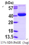 Human OGG1 Protein (Recombinant His)