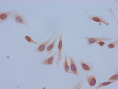 HIST1H2BB Antibody