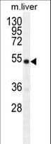 GDF6 / BMP13 Antibody (aa31-59)