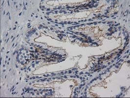 PACSIN3 Antibody (clone OTI2E4)