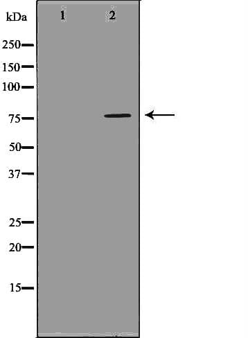 ATF6 Antibody