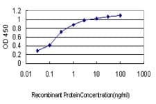 LTBP2 Antibody (clone 5D7)