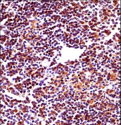 Polyclonal Rabbit anti-Human RBM22 Antibody (aa165-193, IHC, WB)