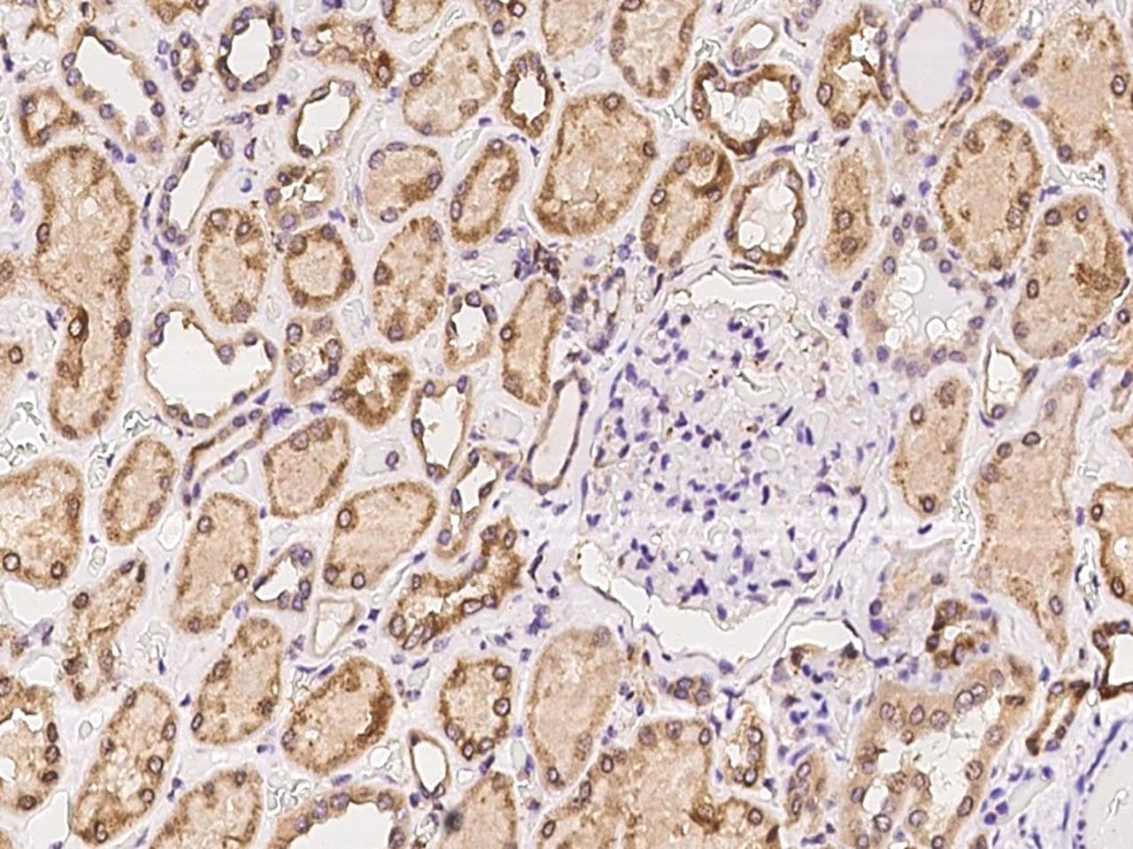 GLIPR1 / GLIPR Antibody