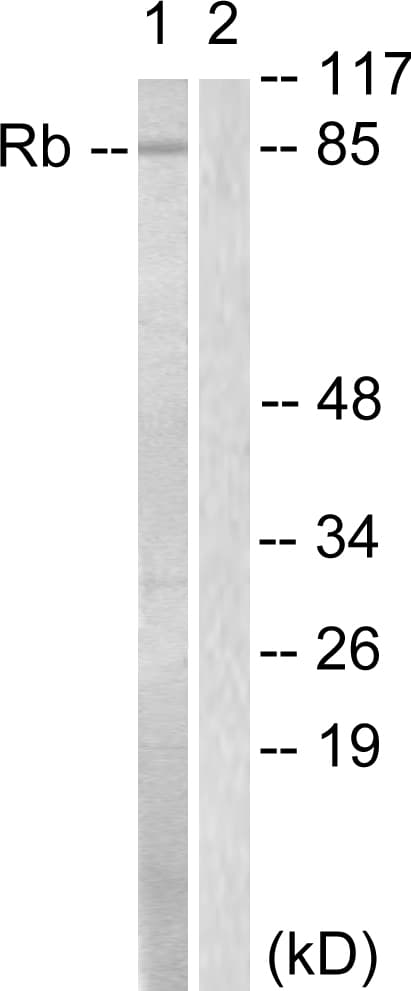 RB1 / Retinoblastoma / RB Antibody (aa771-820)
