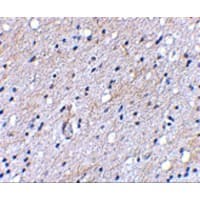 Polyclonal Rabbit anti-Human BAIAP3 Antibody (IHC, WB)