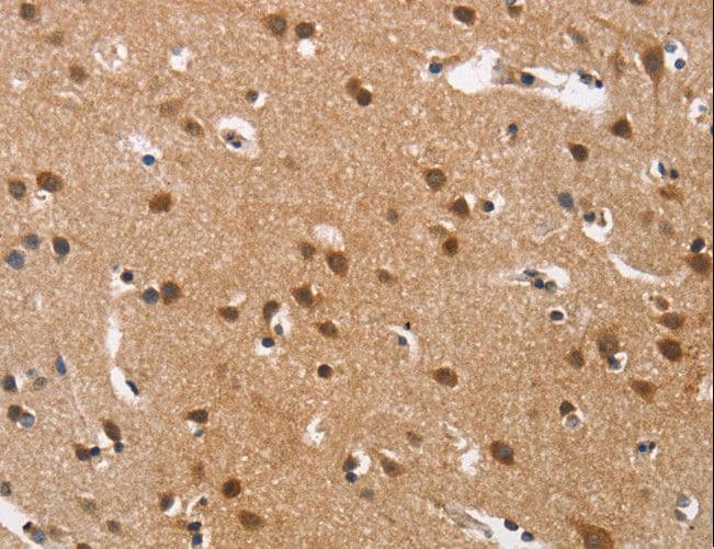 CACNA1D / Cav1.3 Antibody