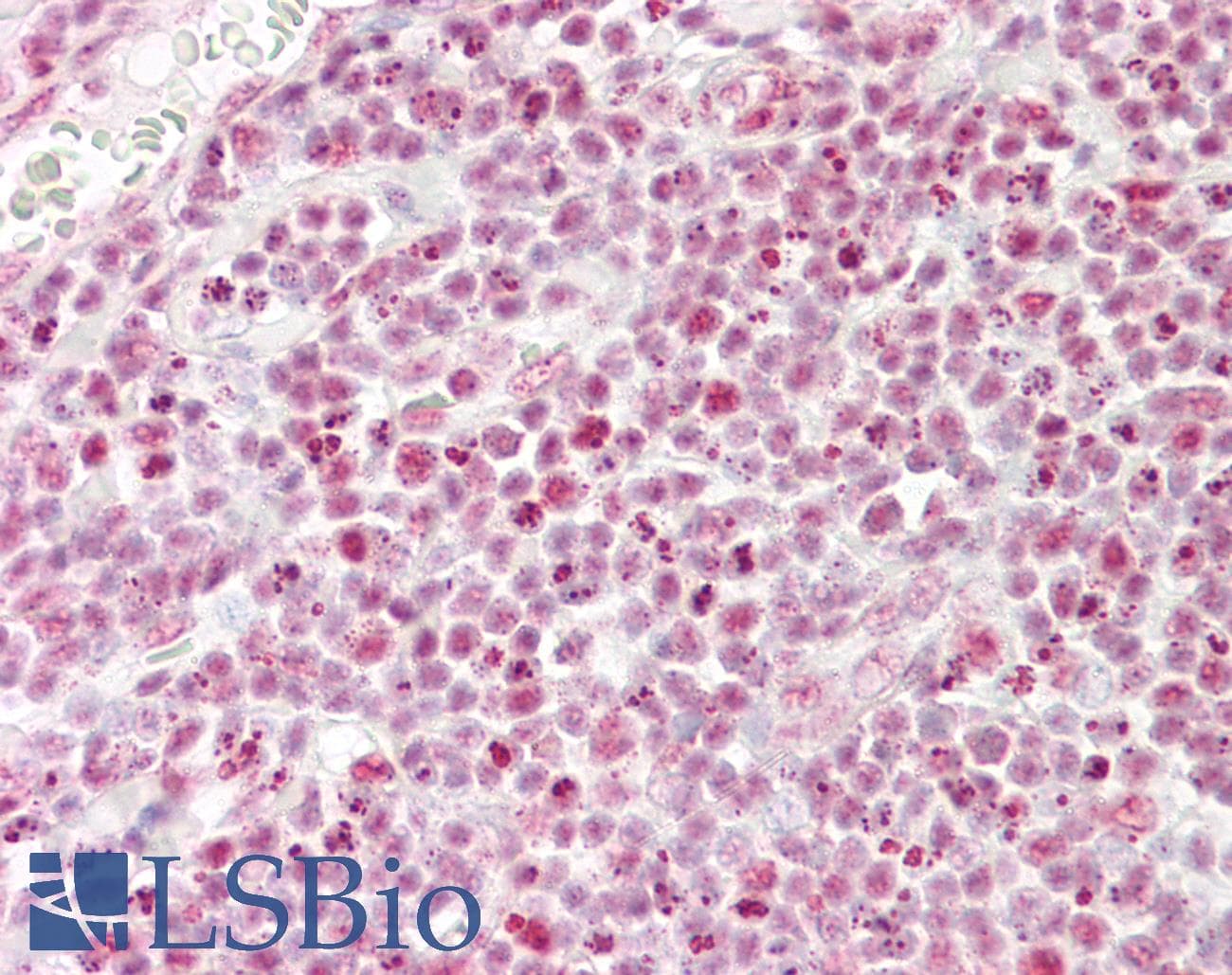 IHC-plus™ MYC / c-Myc Antibody (aa 398-439)