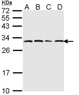 Polyclonal Rabbit anti-Human PSMA6 Antibody (aa57-274, IHC, WB)