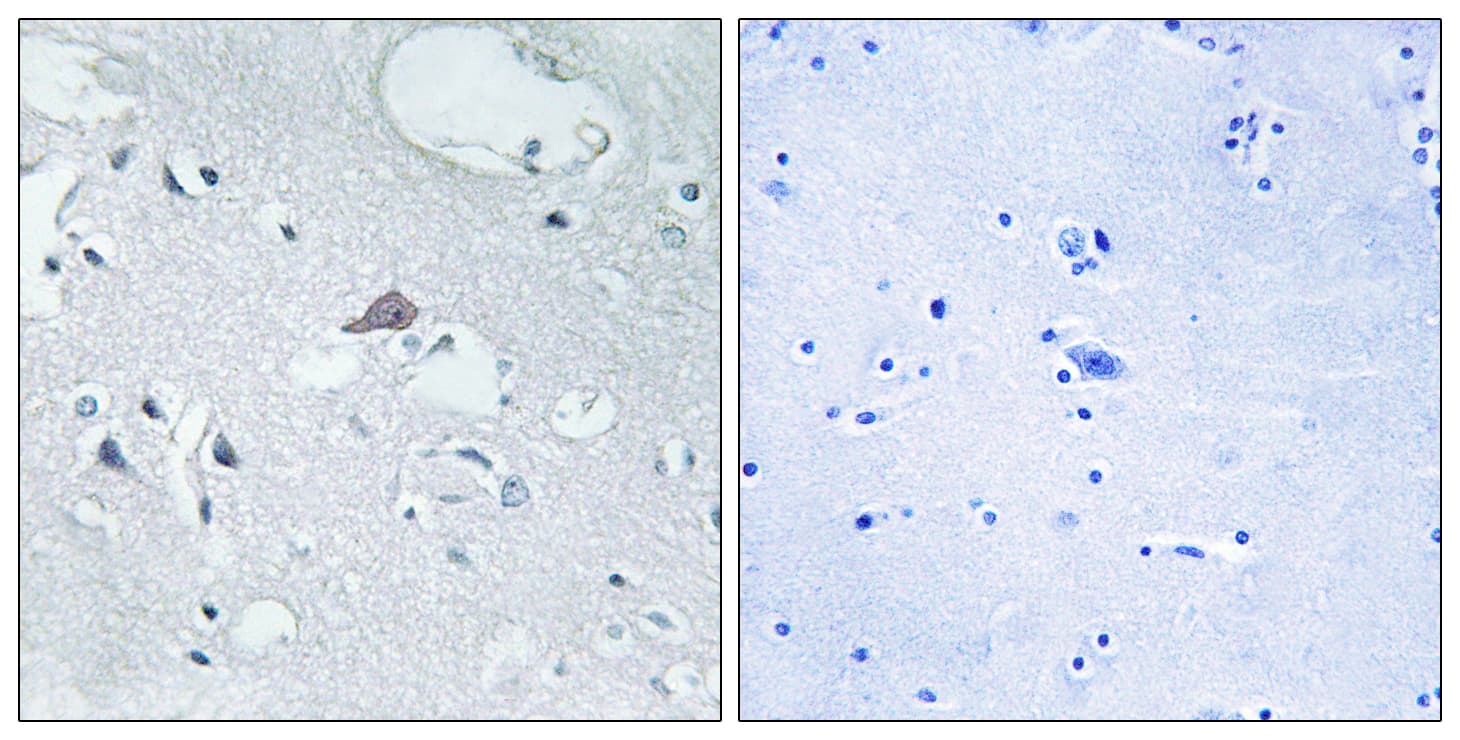 OPRM1 / Mu Opioid Receptor Antibody (aa21-70)