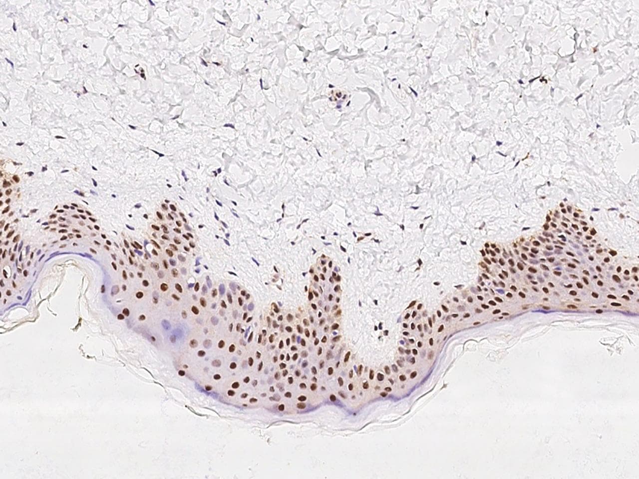 RAP30 / GTF2F2 Antibody