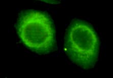 CHD3 Antibody (C-Terminus)