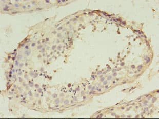 Polyclonal Rabbit anti-Human SPANXD Antibody (IHC)