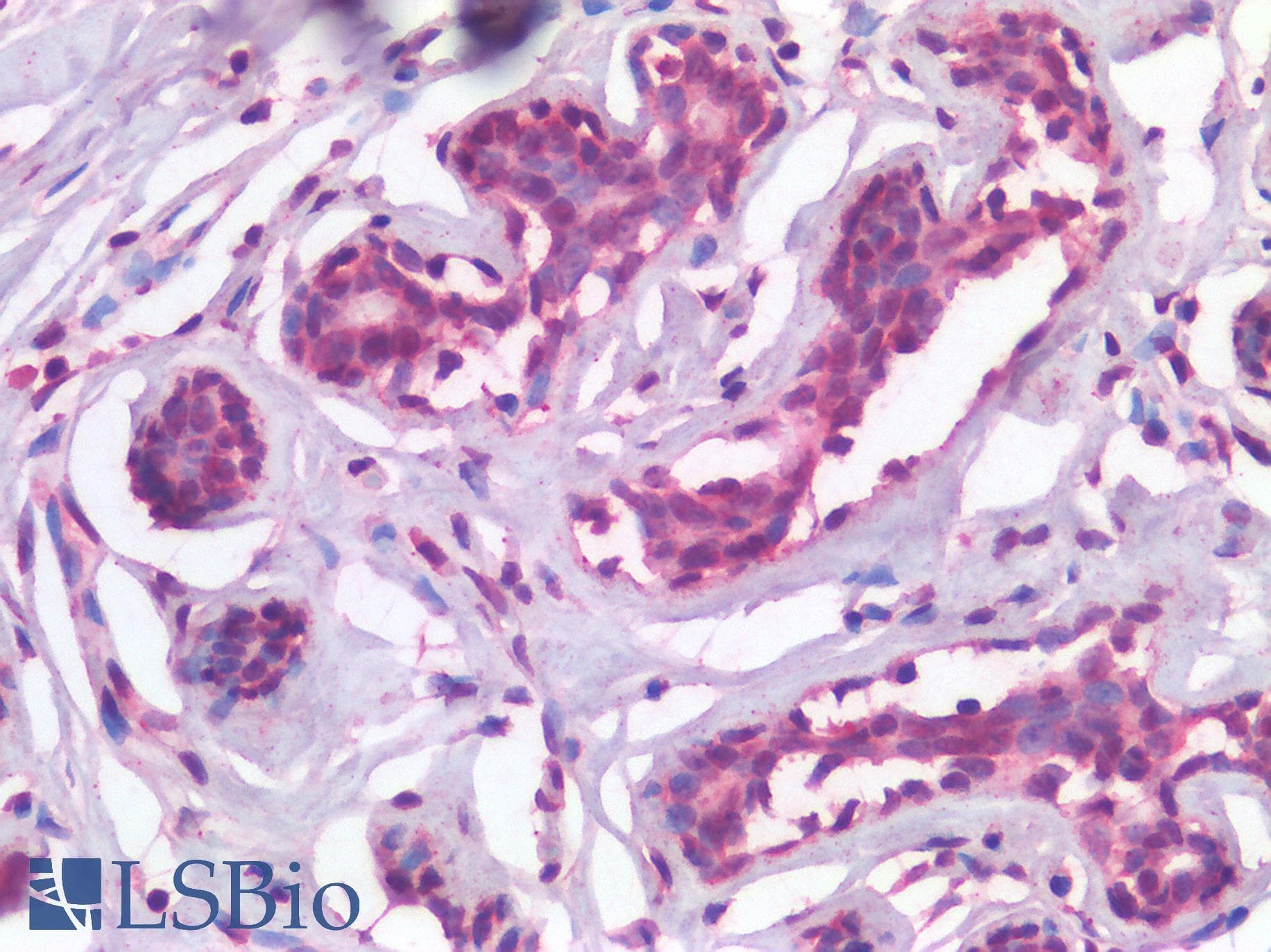 IHC-plus™ Polyclonal Rabbit anti-Human TP63 / p63 Antibody (IHC)