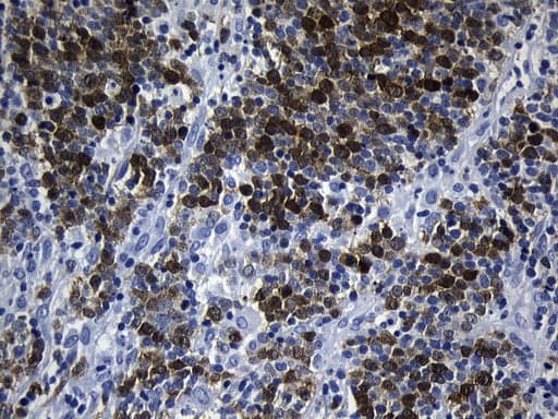 TS / Thymidylate Synthase Antibody (clone UMAB227)
